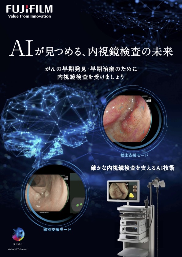 実際の内視鏡検査風景